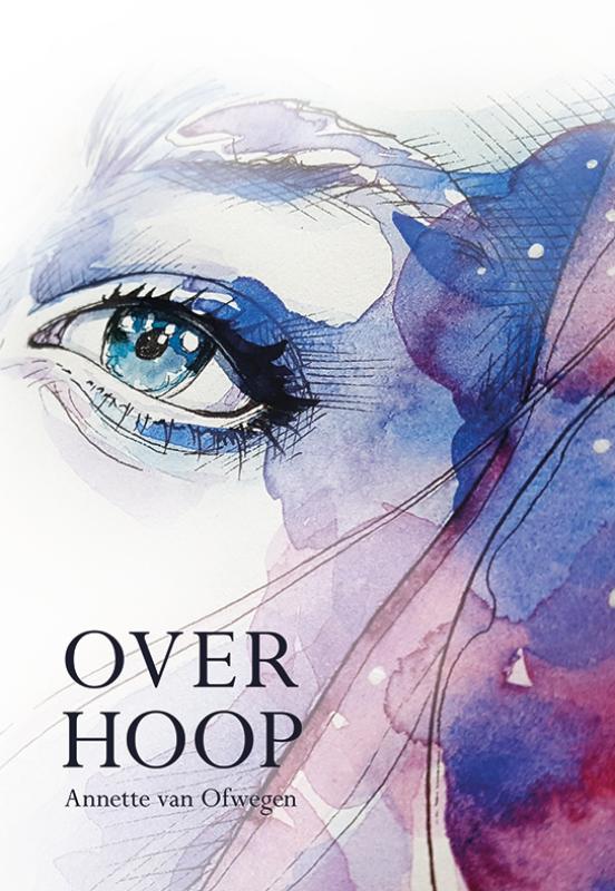 OVERHOOP