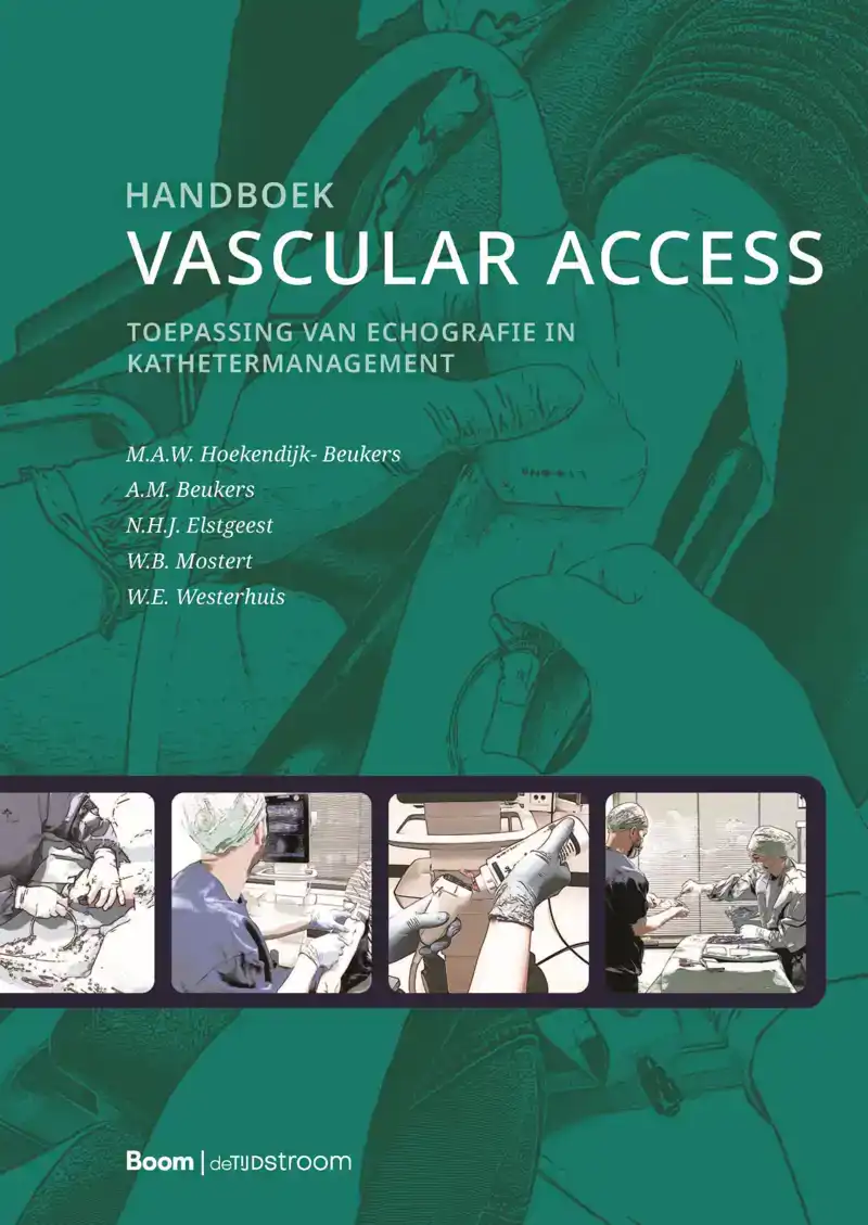 HANDBOEK VASCULAR ACCESS