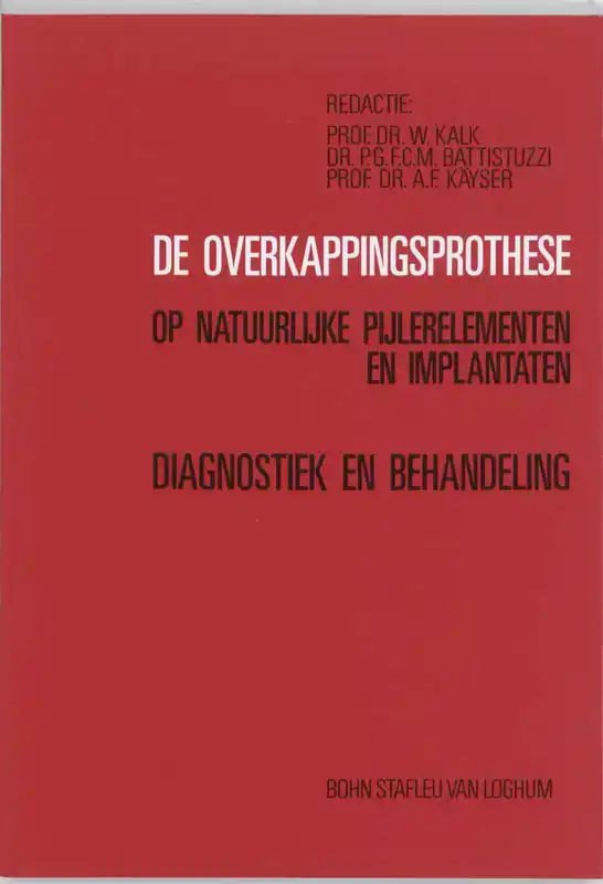 DE OVERKAPPINGSPROTHESE OP NATUURLIJKE PIJLERELEMENTEN EN IM