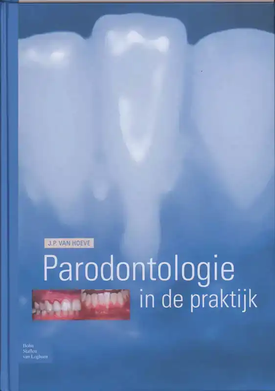 PARODONTOLOGIE IN DE PRAKTIJK