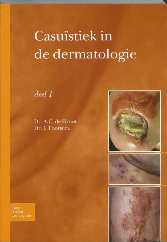 CASUISTIEK IN DE DERMATOLOGIE