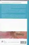 ZAKBOEK MONDZIEKTEN, KAAK- EN AANGEZICHTCHIRURGIE
