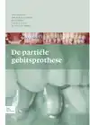 DE PARTIELE GEBITSPROTHESE