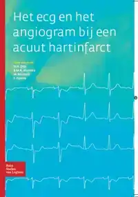 HET ECG EN HET ANGIOGRAM BIJ EEN ACUUT HARTINFARCT