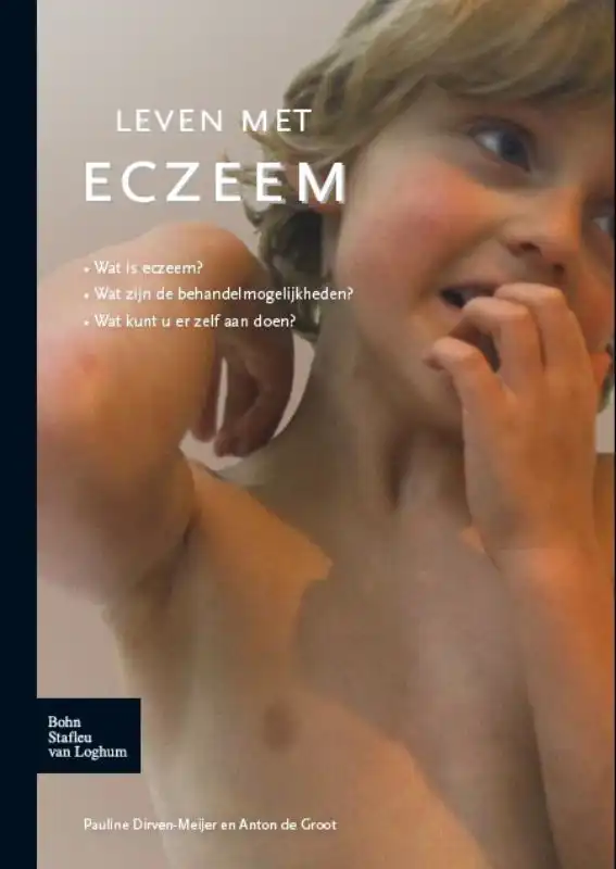 LEVEN MET ECZEEM