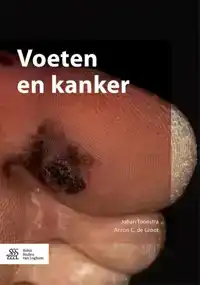 VOETEN EN KANKER