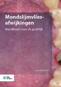 MONDSLIJMVLIESAFWIJKINGEN