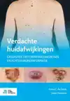 VERDACHTE HUIDAFWIJKINGEN