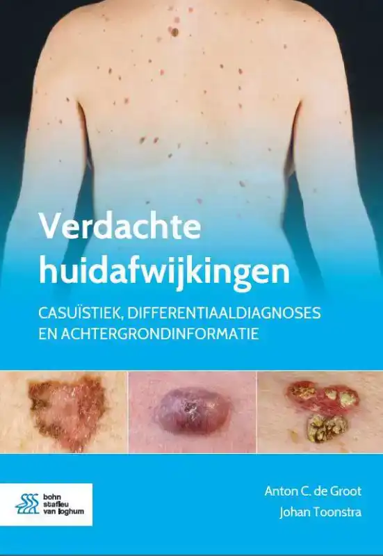 VERDACHTE HUIDAFWIJKINGEN
