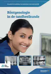 RONTGENOLOGIE IN DE TANDHEELKUNDE