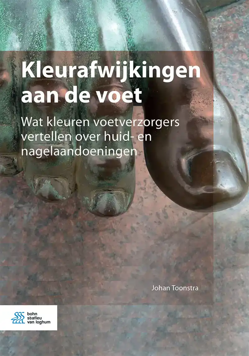 KLEURAFWIJKINGEN AAN DE VOET