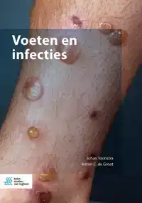 VOETEN EN INFECTIES