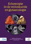 ECHOSCOPIE IN DE VERLOSKUNDE EN GYNAECOLOGIE