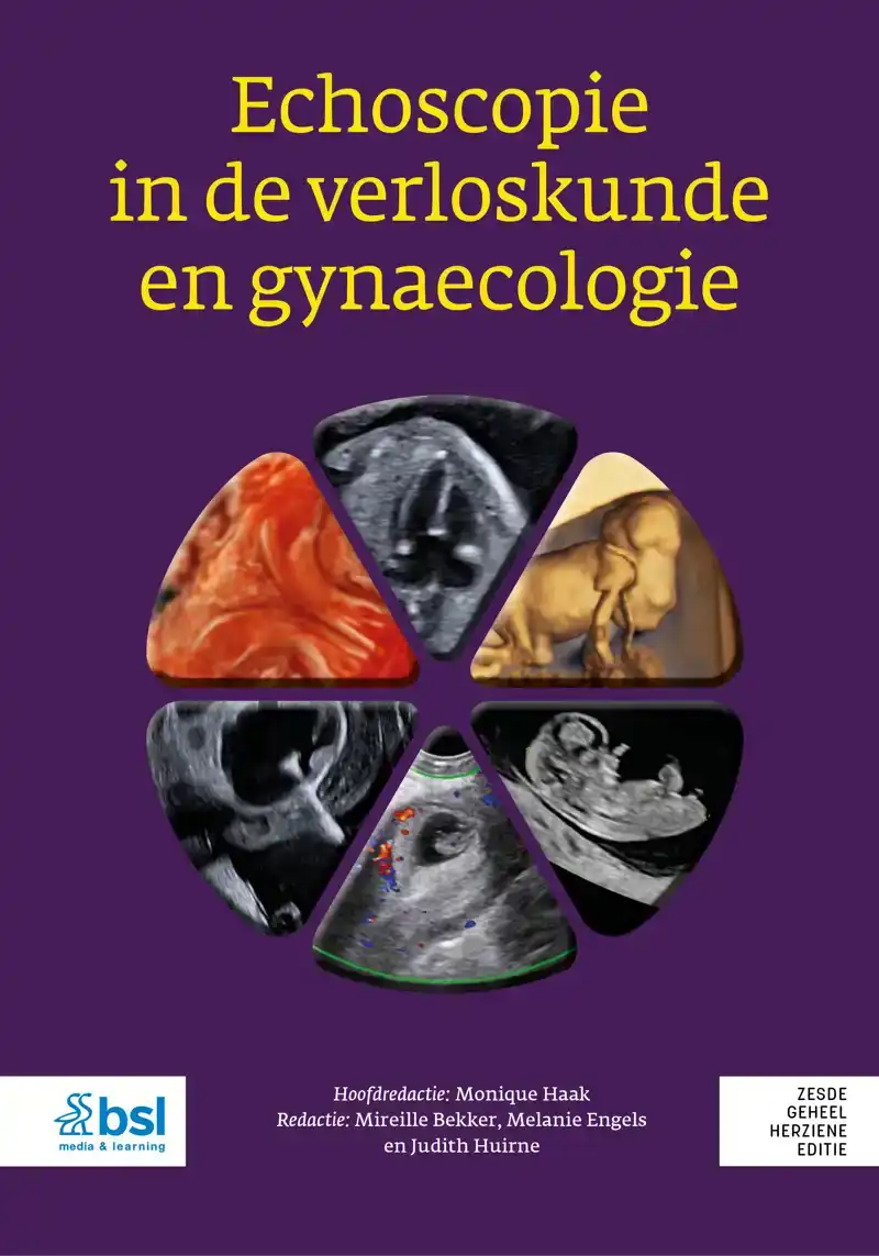 ECHOSCOPIE IN DE VERLOSKUNDE EN GYNAECOLOGIE