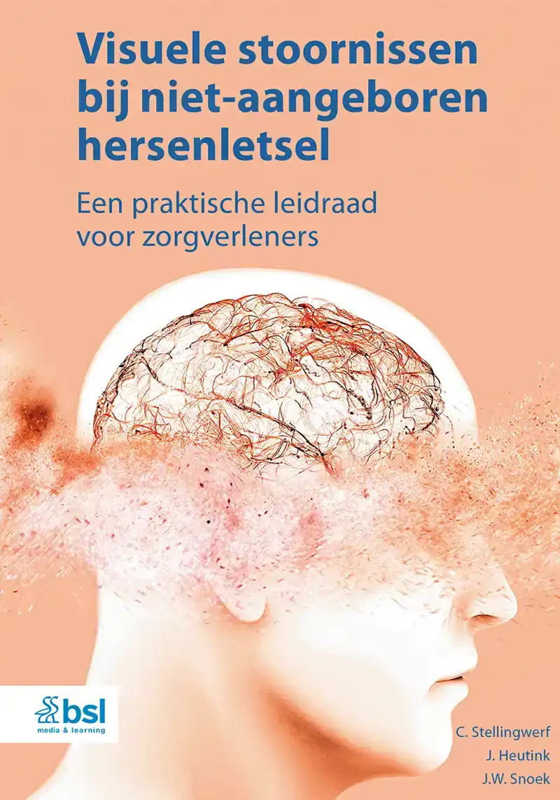 VISUELE STOORNISSEN BIJ NIET-AANGEBOREN HERSENLETSEL