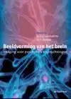 BEELDVORMING VAN HET BREIN