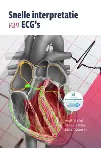 SNELLE INTERPRETATIE VAN ECG'S