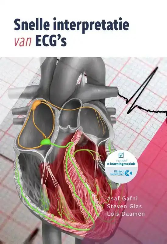 SNELLE INTERPRETATIE VAN ECG'S