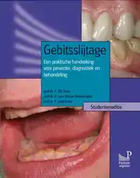 GEBITSSLIJTAGE