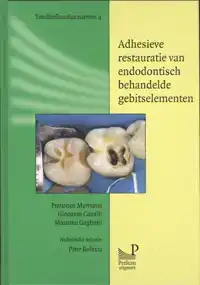 ADHESIEVE RESTAURATIE VAN ENDODONTISCH BEHANDELDE GEBITSELEM