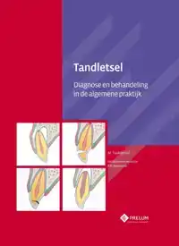 TANDLETSEL