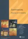 CARIESLAESIES-STUDENTENEDITIE