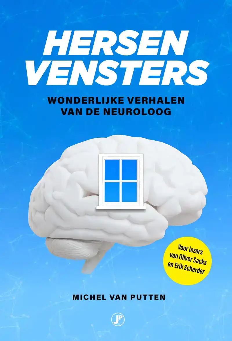 HERSENVENSTERS