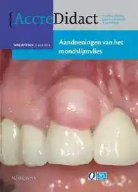 AANDOENINGEN VAN HET MONDSLIJMVLIES