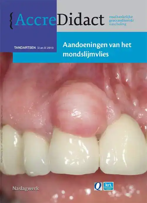 AANDOENINGEN VAN HET MONDSLIJMVLIES