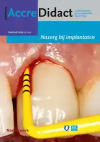 NAZORG BIJ IMPLANTATEN