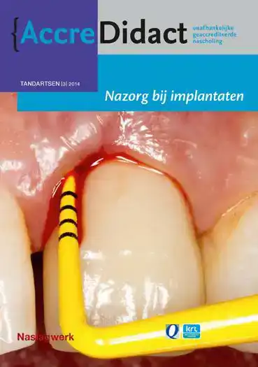 NAZORG BIJ IMPLANTATEN