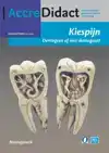 KIESPIJN, DENTOGEEN OF NIET-DENTOGEEN?