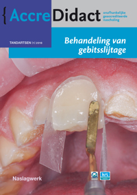 BEHANDELING VAN GEBITSSLIJTAGE