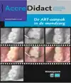 DE ART-AANPAK IN DE MONDZORG