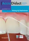 NAZORG BIJ IMPLANTATEN