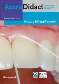 NAZORG BIJ IMPLANTATEN