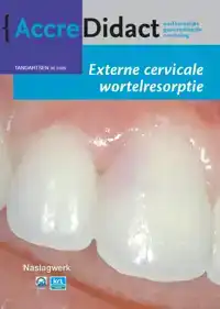 EXTERNE CERVICALE WORTELRESORPTIE