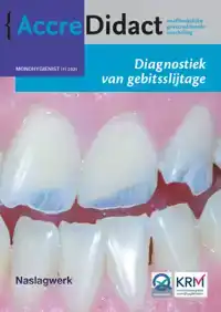 DIAGNOSTIEK VAN GEBITSSLIJTAGE