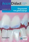 DIAGNOSTIEK VAN GEBITSSLIJTAGE