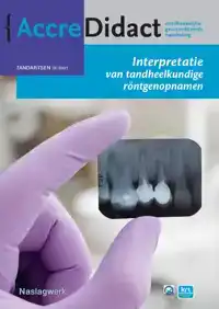 INTERPRETATIE VAN TANDHEELKUNDIGE RONTGENOPNAMEN