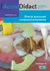 DIRECTE POSTERIORE COMPOSIETRESTAURATIES