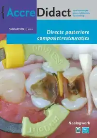 DIRECTE POSTERIORE COMPOSIETRESTAURATIES