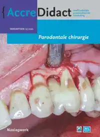 PARODONTALE CHIRURGIE