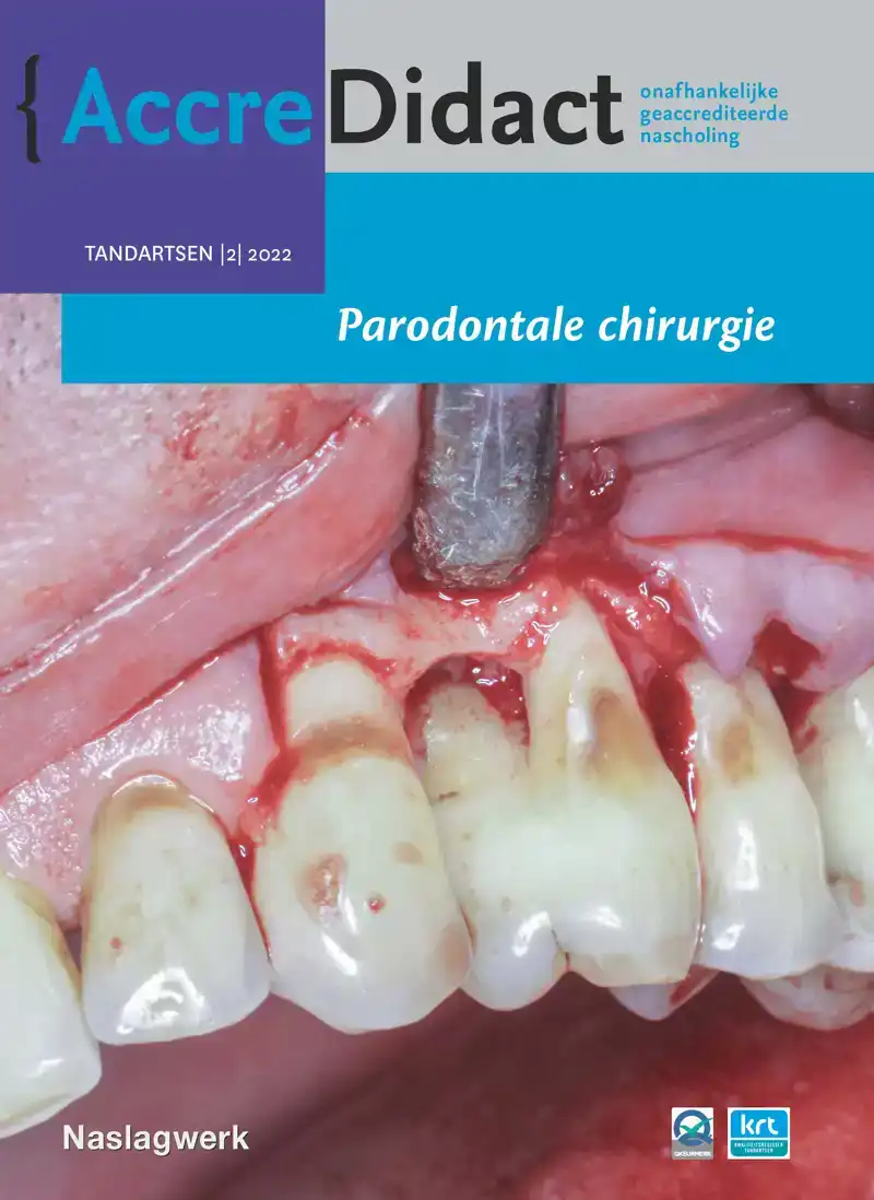 PARODONTALE CHIRURGIE
