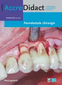 PARODONTALE CHIRURGIE