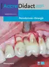 PARODONTALE CHIRURGIE