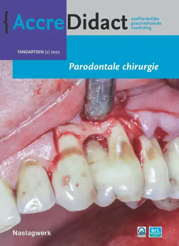 PARODONTALE CHIRURGIE