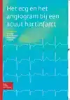 HET ECG EN HET ANGIOGRAM BIJ EEN ACUUT HARTINFARCT